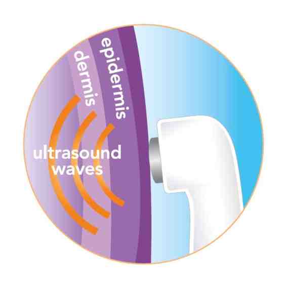 ULTRALIEVE MASSAGER ULTRASOUND THERAPY